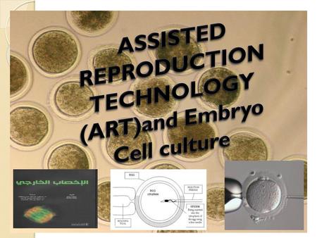 ASSISTED REPRODUCTION TECHNOLOGY (ART)and Embryo Cell culture