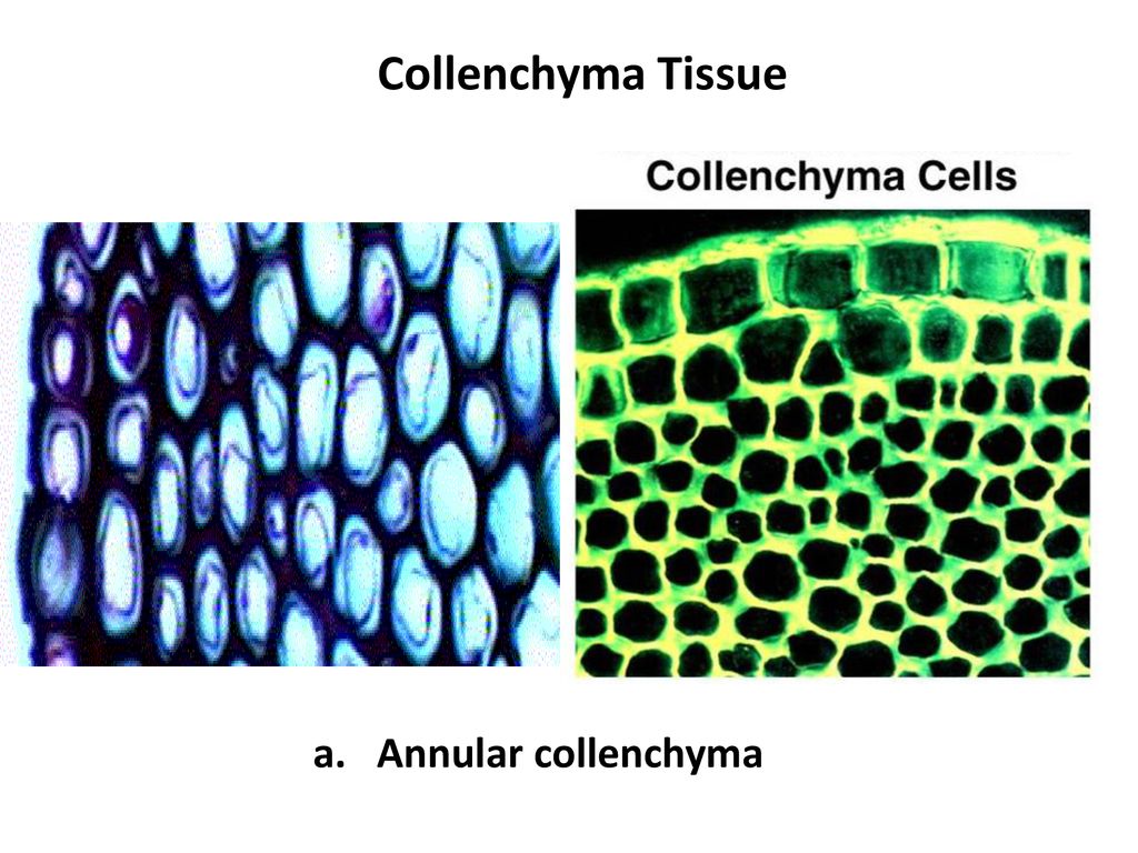 Collenchyma Tissue a. Annular collenchyma
