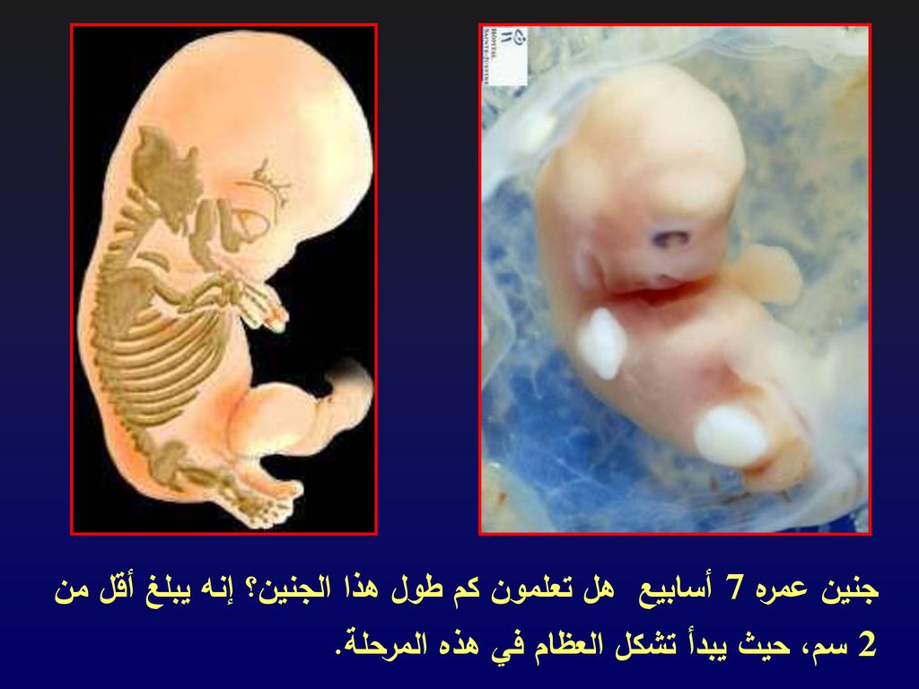 جنين عمره 7 أسابيع هل تعلمون كم طول هذا الجنين؟ إنه يبلغ أقل من 2 سم، حيث يبدأ تشكل العظام في هذه المرحلة.