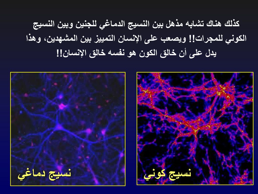 كذلك هناك تشابه مذهل بين النسيج الدماغي للجنين وبين النسيج الكوني للمجرات!! ويصعب على الإنسان التمييز بين المشهدين، وهذا يدل على أن خالق الكون هو نفسه خالق الإنسان!!