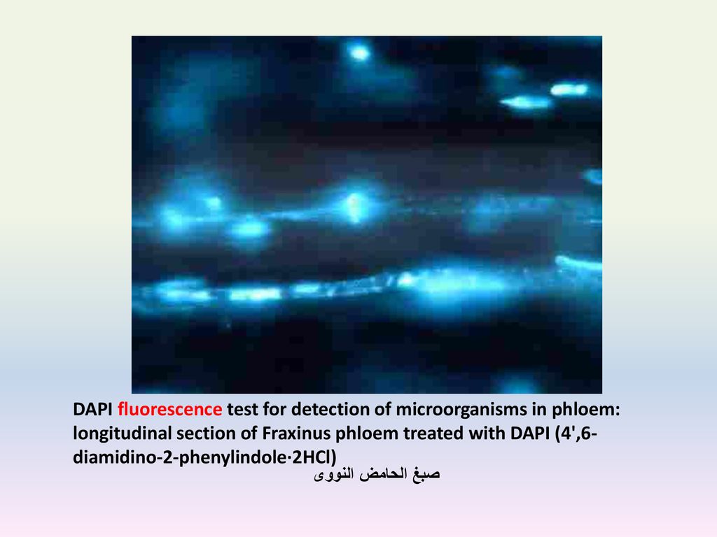 DAPI fluorescence test for detection of microorganisms in phloem: longitudinal section of Fraxinus phloem treated with DAPI (4 ,6-diamidino-2-phenylindole·2HCl)
