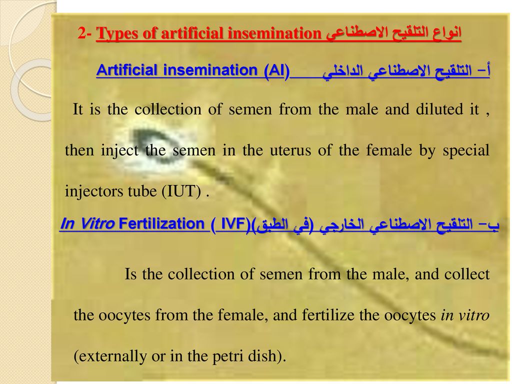 2- Types of artificial inseminationانواع التلقيح الاصطناعي