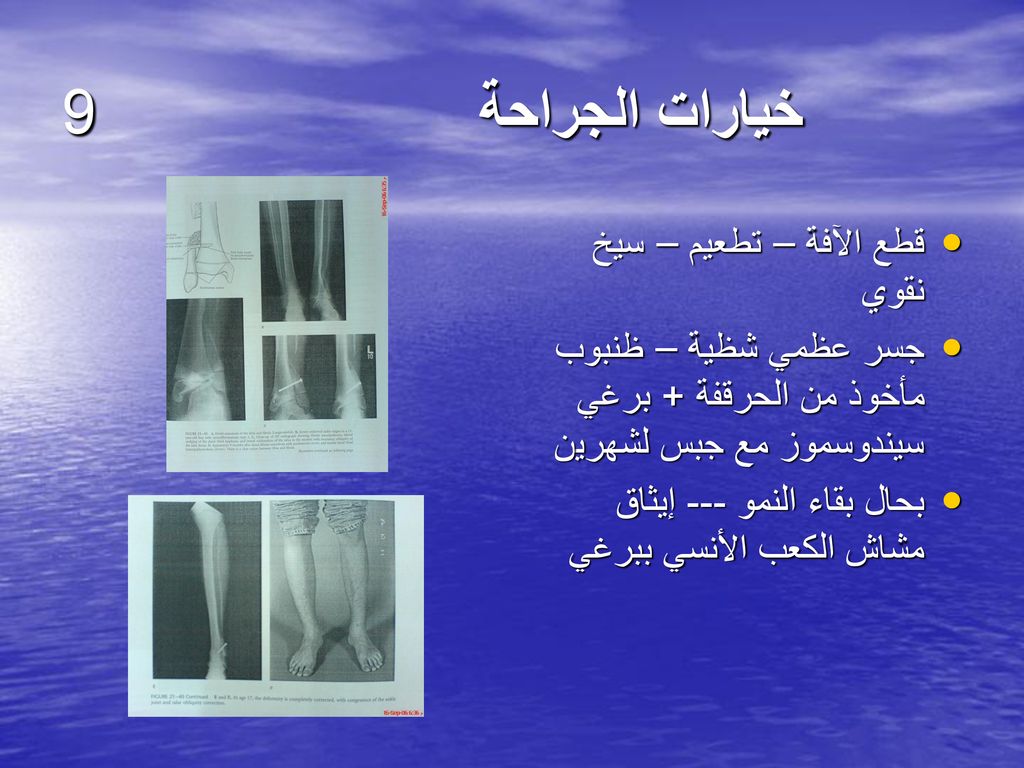 خيارات الجراحة 9 قطع الآفة – تطعيم – سيخ نقوي